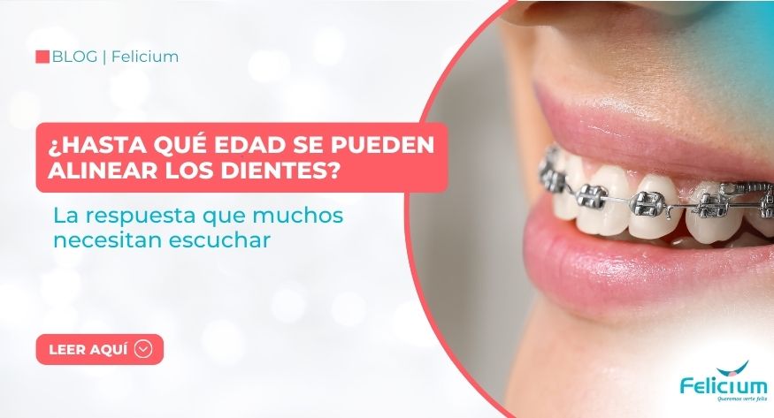 ¿Hasta qué edad se pueden alinear los dientes?