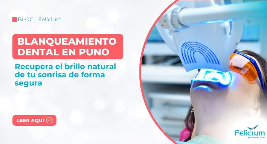 Blanqueamiento dental en Puno