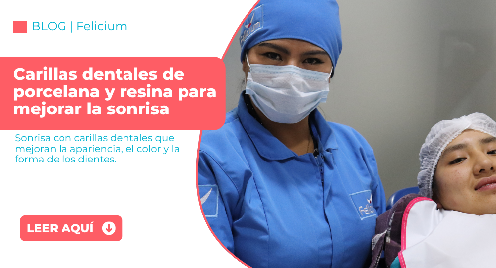Sonrisa con carillas dentales que mejoran la apariencia, el color y la forma de los dientes.